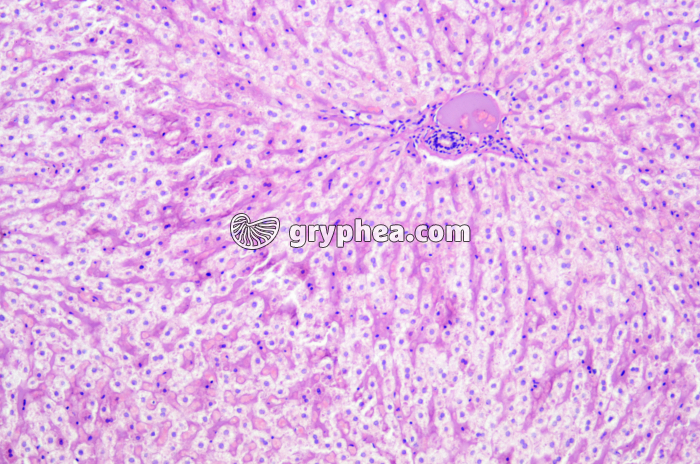 Foie injecté x45 - gryphea.org